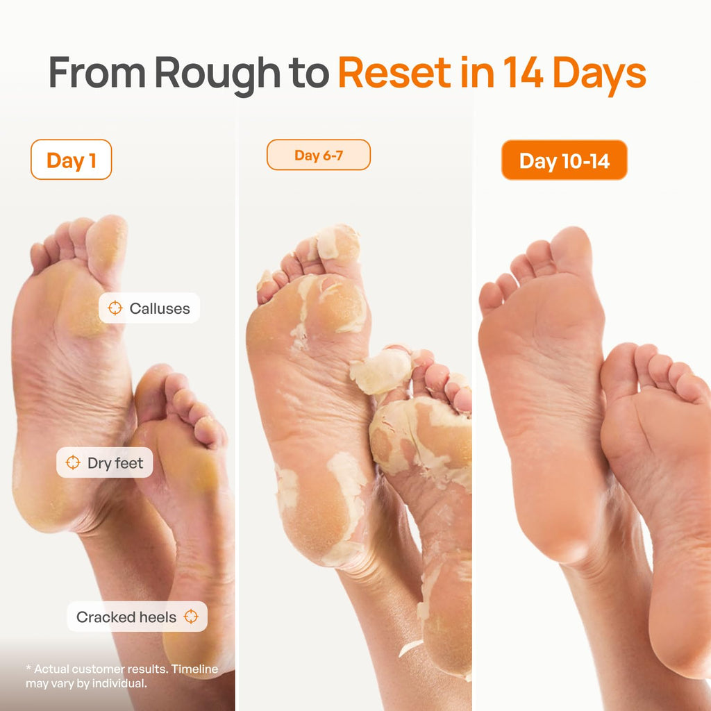 PLANTIFIQUE Foot Peeling Mask, Dermatologically Tested - 2 Pairs, Peach
