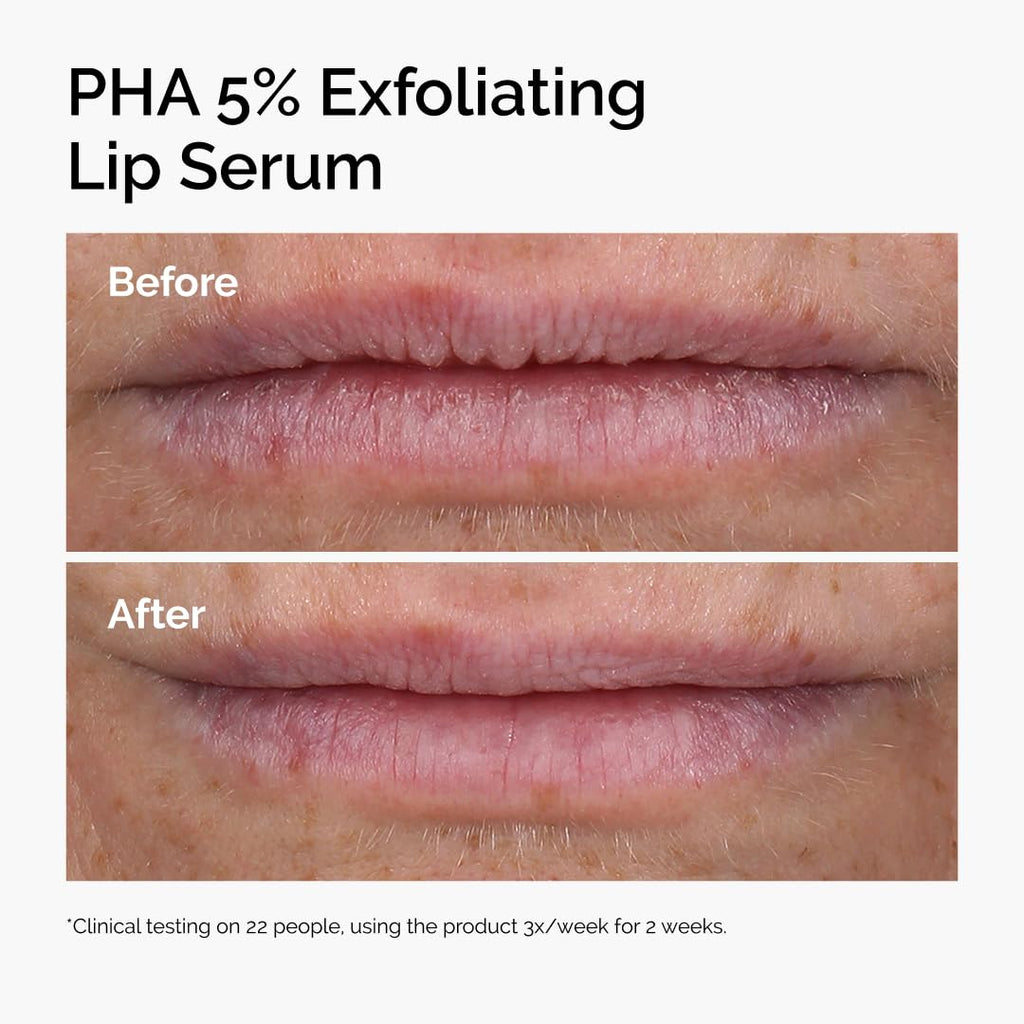 The Ordinary PHA 5% Exfoliating Lip Serum, Hydrating Overnight Lip Exfoliator Treatment