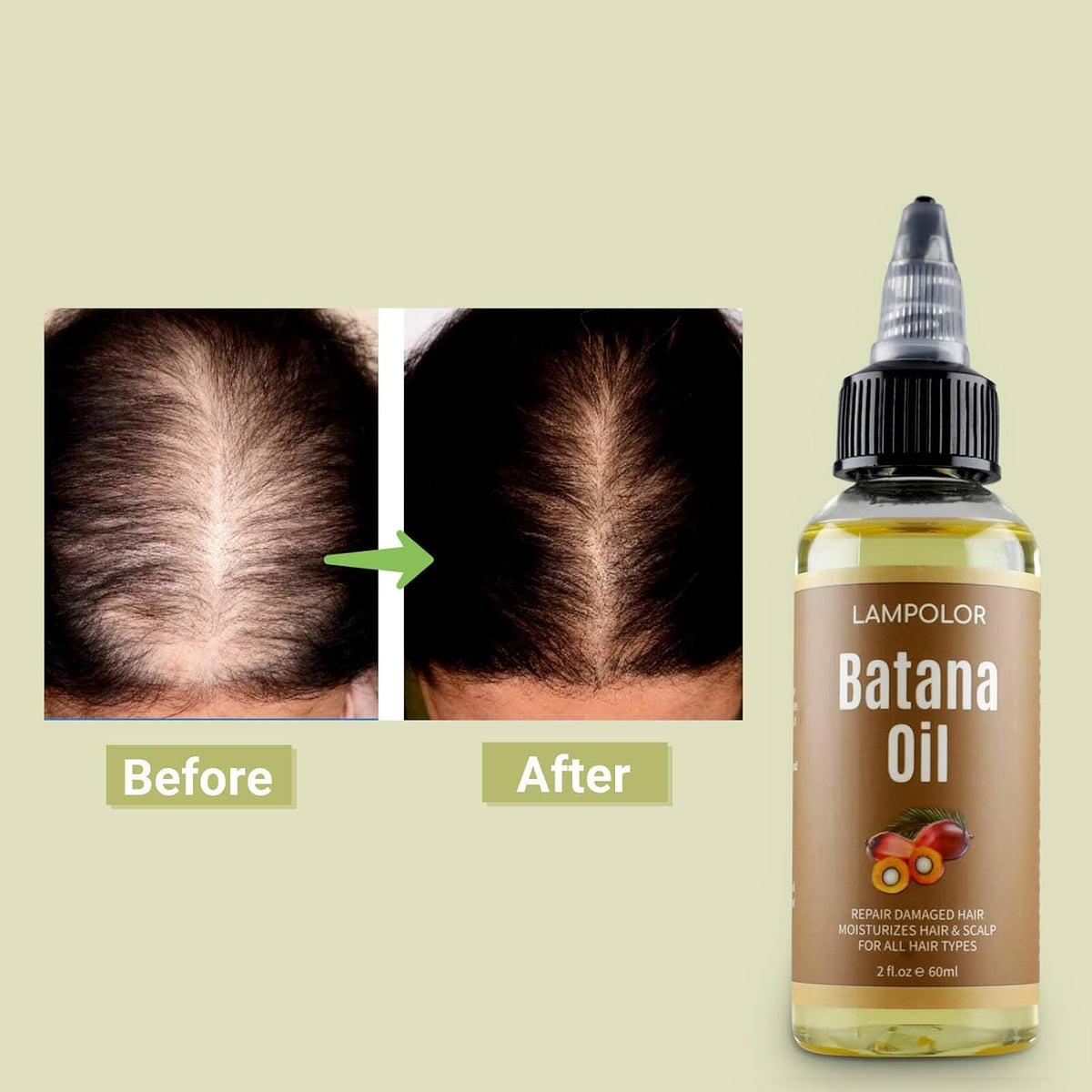 RAW Batana Oil for Hair Growth, Dr Sebi Organic Unrefined Batana Oil from Honduran, 100% Pure & Natural Hair Growth for 