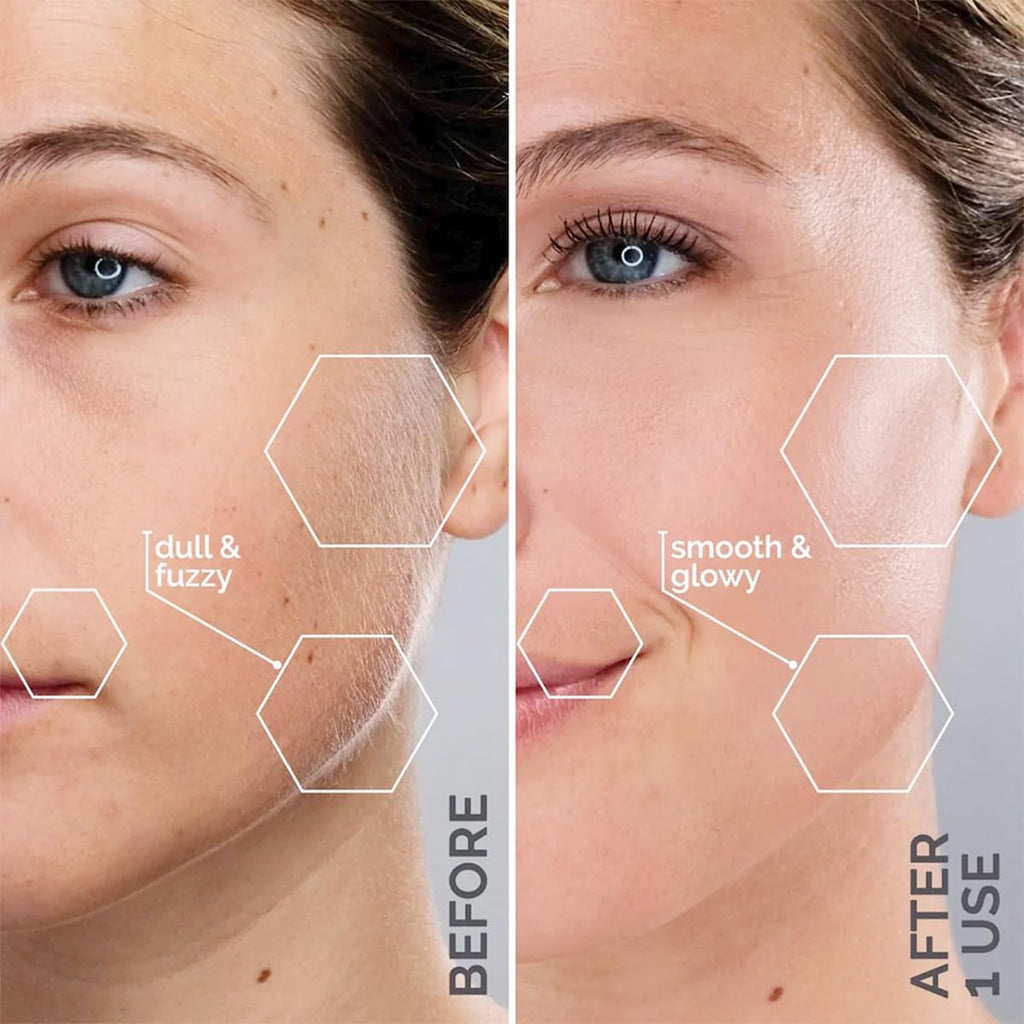 Michael Todd Beauty Sonicsmooth Dermaplane Razor for Women Face