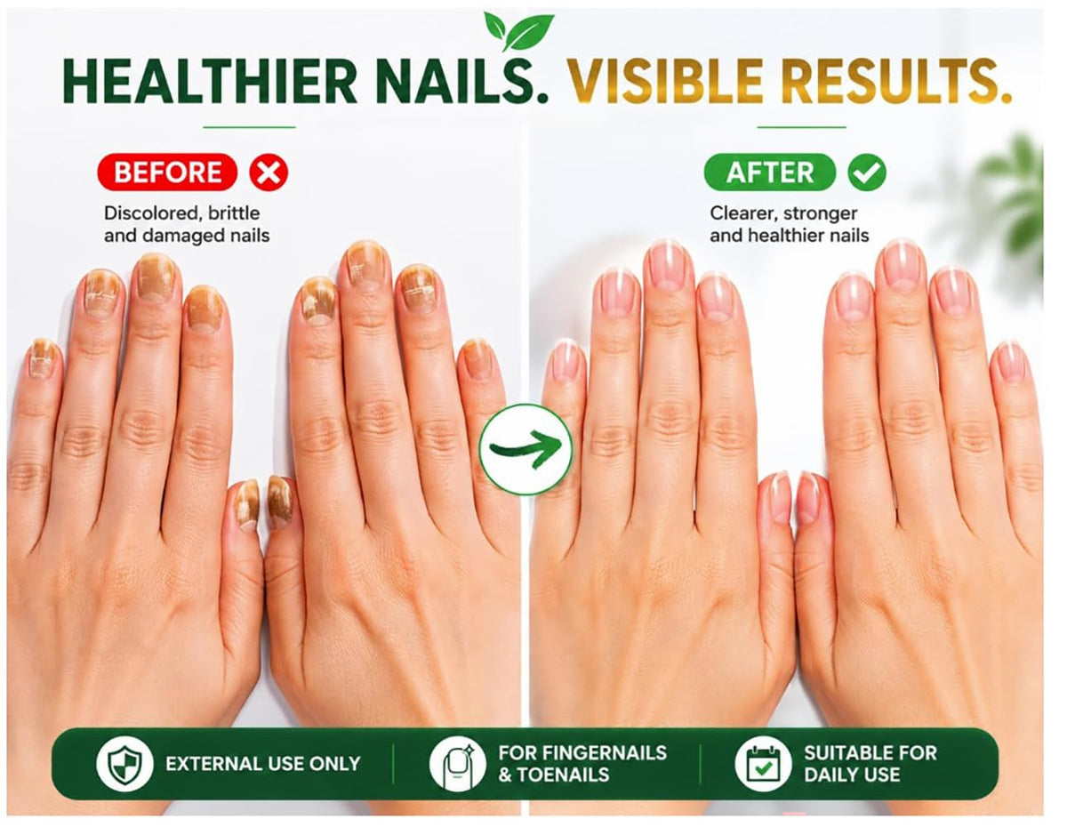 Nail Treatment | Tratamiento para uñas | 0.5oz | Made in USA (0.5 FL Oz (Pack of 1))