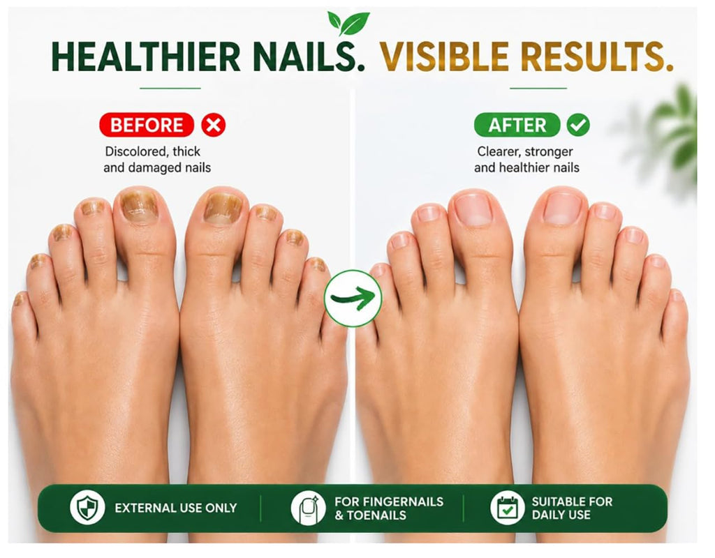Nail Treatment | Tratamiento para uñas | 0.5oz | Made in USA (0.5 FL Oz (Pack of 1))