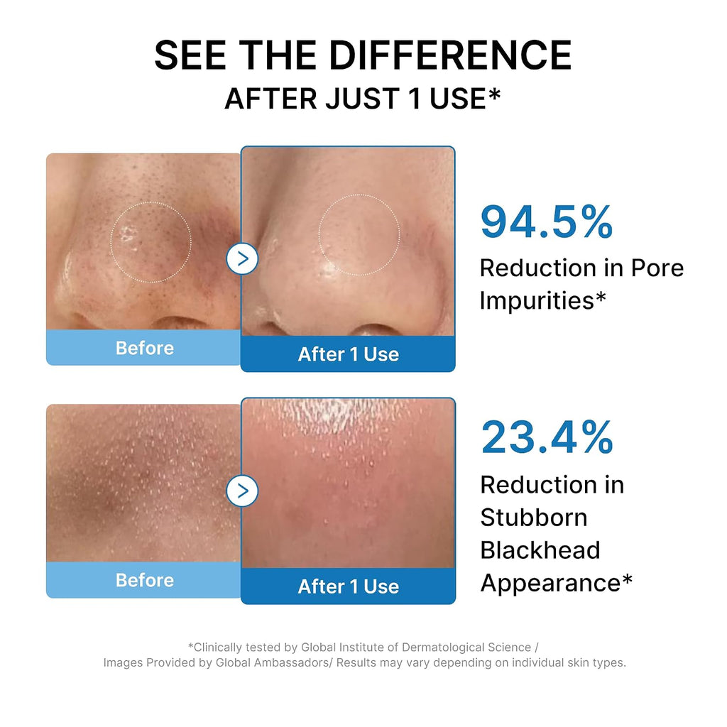 medicube Cleansing Oil Zero Pore, Makeup Remover, Blackhead & Pore Care