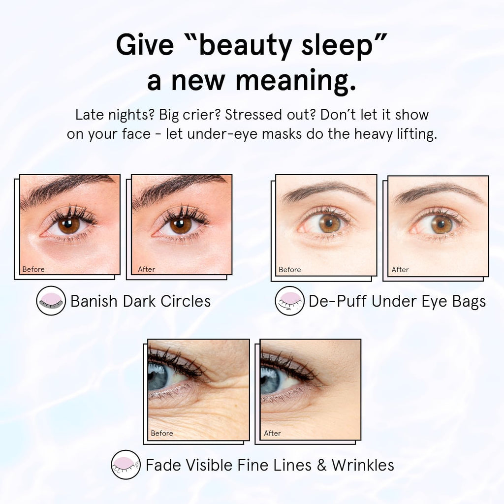 grace & stella Retinol Under Eye Patches for Wrinkles (Purple,24 Pairs)