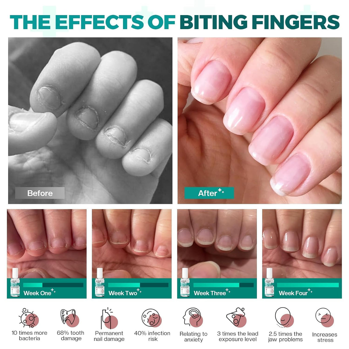 Morovan Nail Biting Prevention Kids Thumb Sucking Deterrent Repai Nails