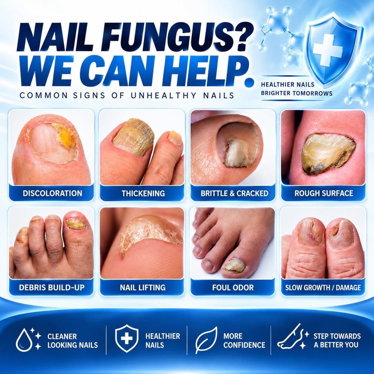 Nail Care Treatment Extra Strength with 25% Undecylenic Acid, 1.01 FLOZ