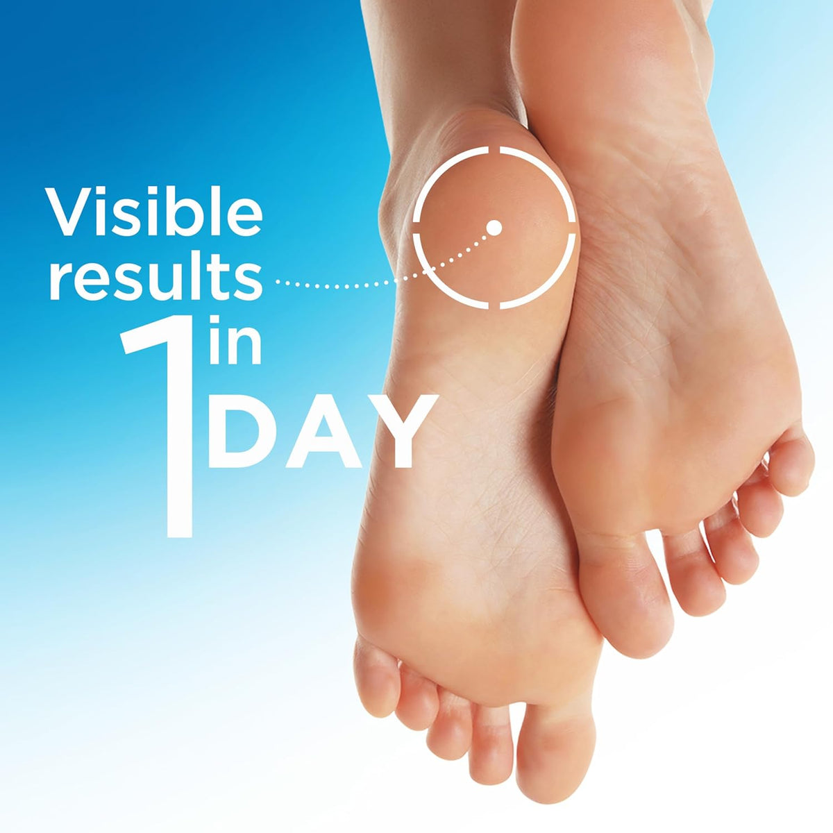 Flexitol Heel Balm 25% Urea Foot Cream for Cracked Heels & Rough Feet, 4 oz