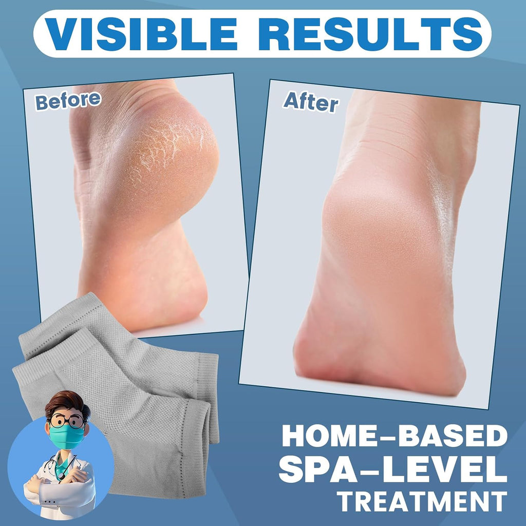 TEAWOO Moisturizing Heel Socks - 6 Pairs for Dry Cracked Feet
