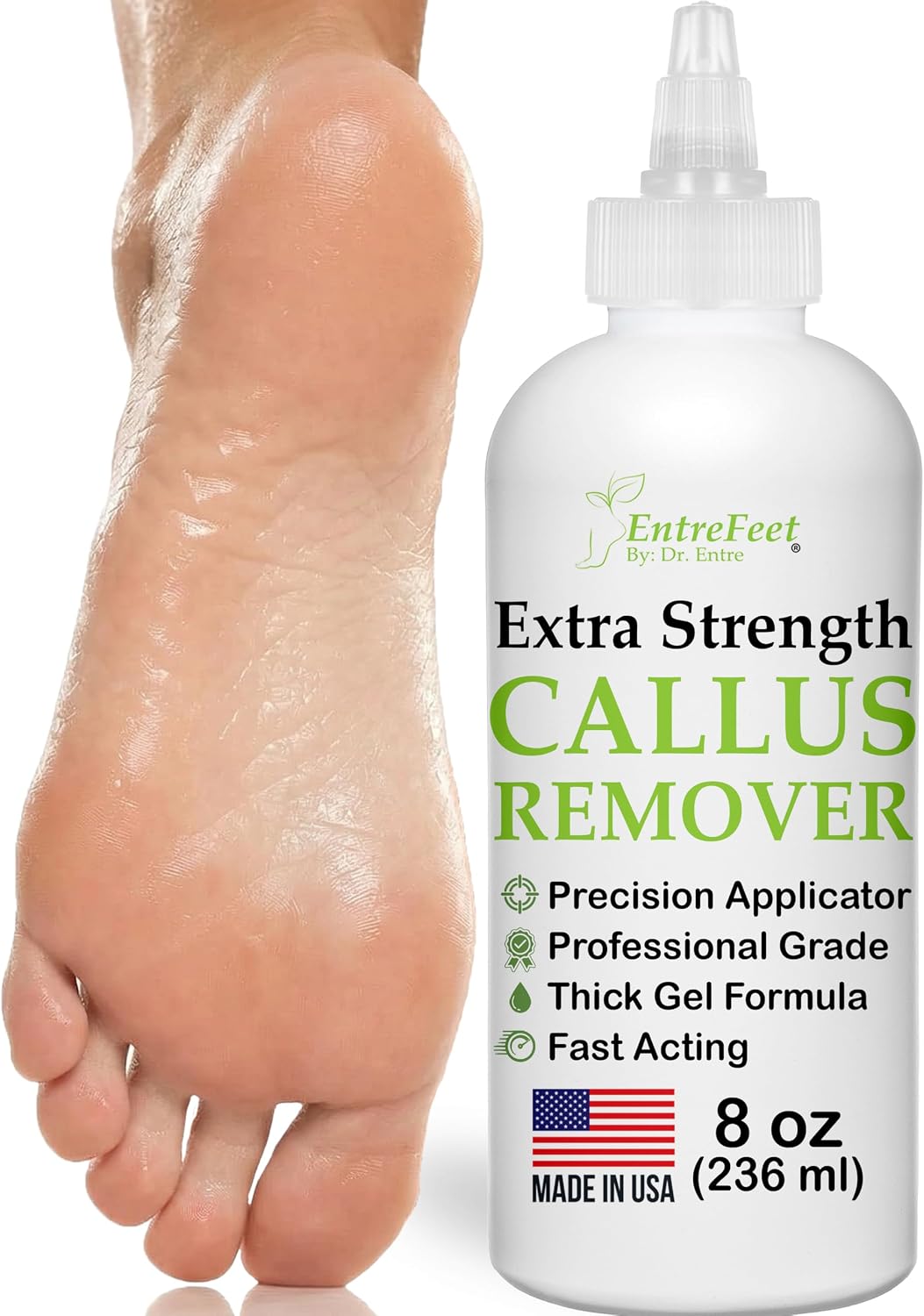 Callus Remover for Feet (Extra Strength 8 oz) Foot Callus Remover Gel
