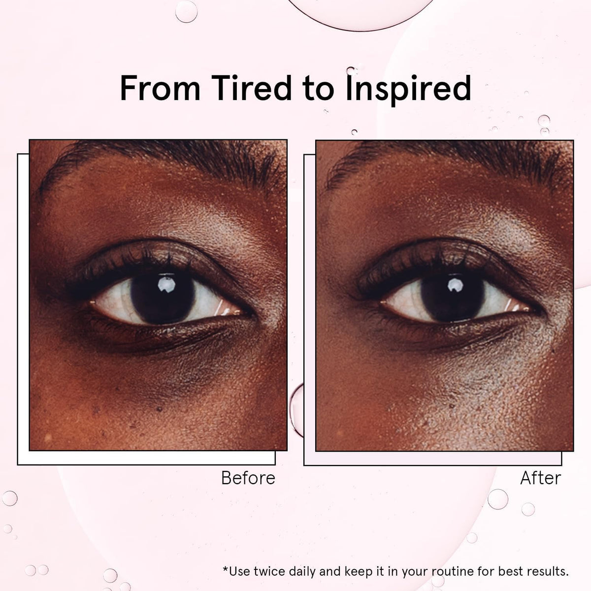 grace & stella Under Eye Serum Roller with Cooling Metal Ball (15ml)
