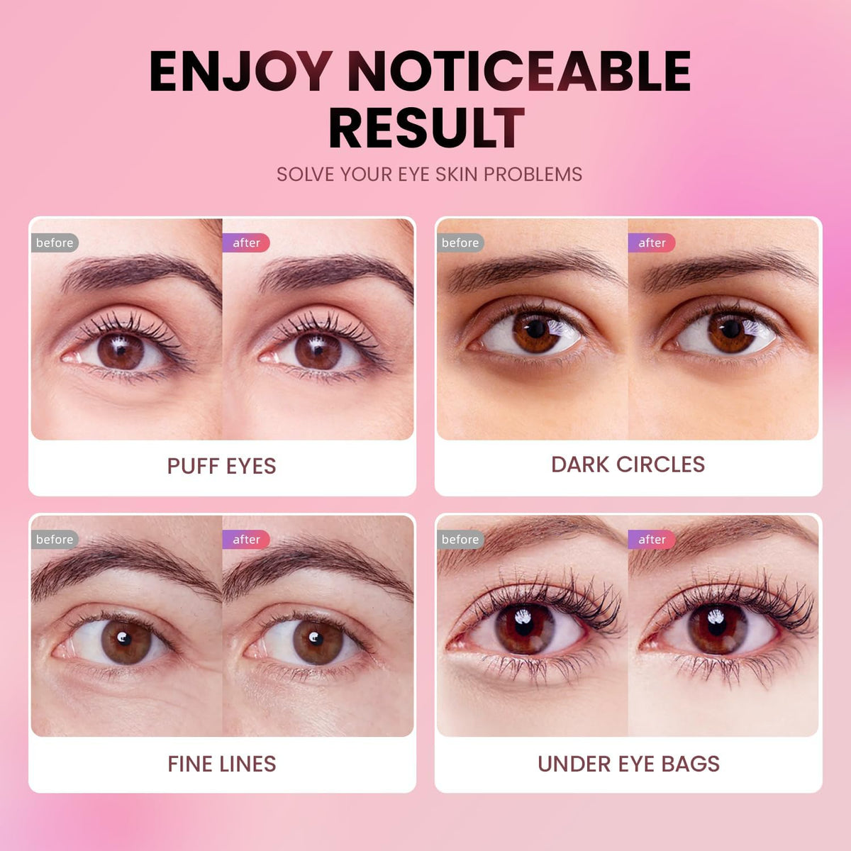 Under Eye Patches (24 Pairs) - Tri-color Glitter Eye Gel Pads for Dark Circles, Puffy Eyes, Under eye Bags, Wrinkles | N