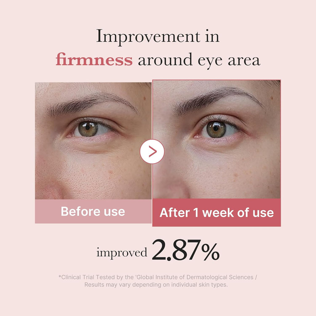 medicube Eye Serum with Salmon DNA PDRN, Peptides & Retinol for Fine Lines