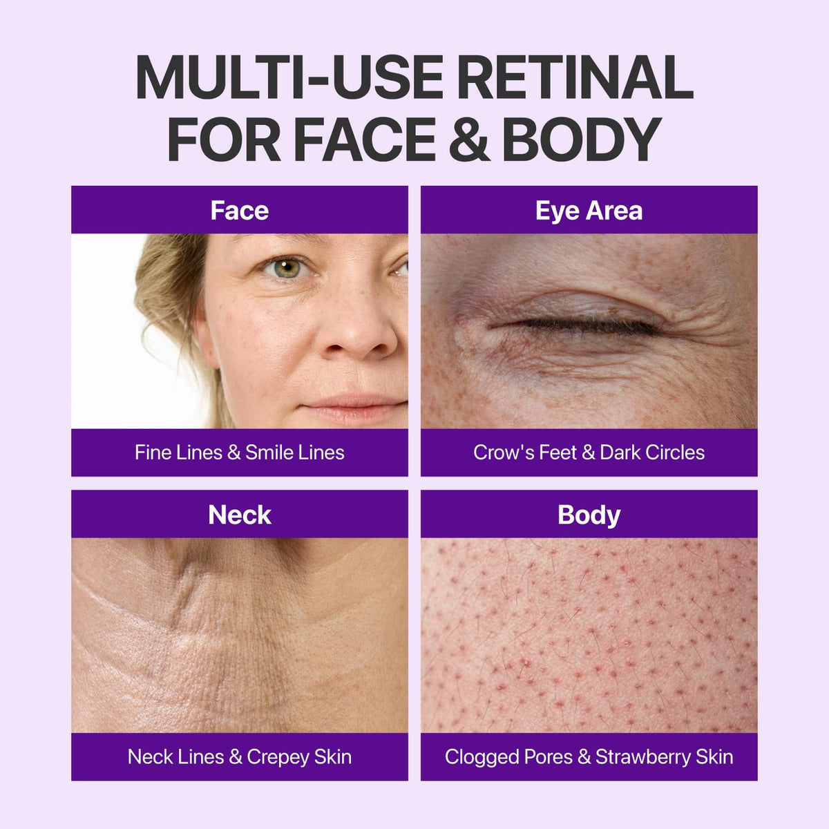 numbuzin No.9 NAD+ Retinal Eye Cream for Anti-Aging, Strawberry Skin, Firmer Skin with Retinoid, Peptides & Niacinamide,