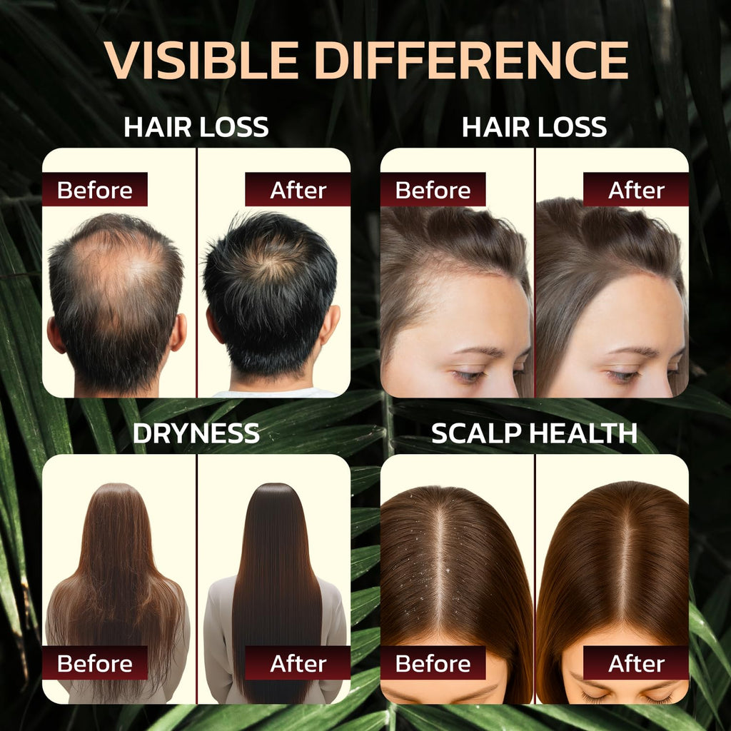 Batana Oil for Hair Growth - 100% Pure & Unrefined Raw Dr Sebi Botana Oil