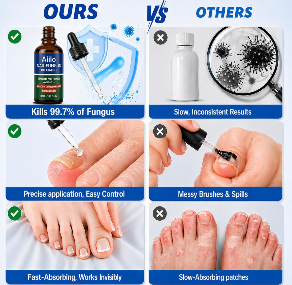 Nail Care Treatment Extra Strength with 25% Undecylenic Acid, 1.01 FLOZ
