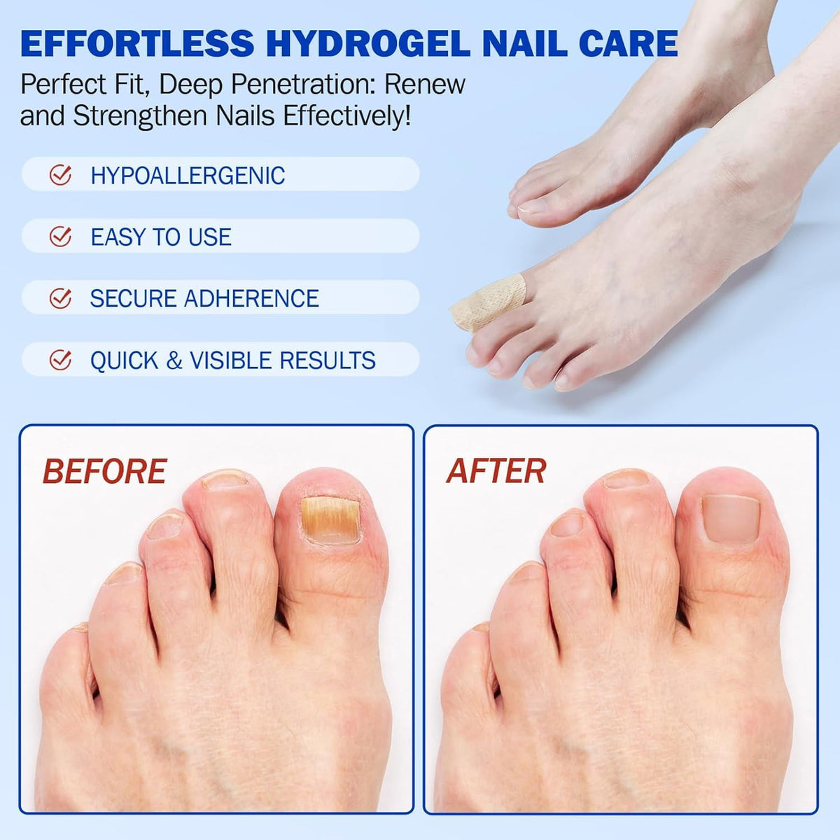 Nail Patches 42 PCS, Toenail Treatment Extra Strength 8-Hour Overnight Nail Fast Acting Repair Effortless Hydrogel Nail 