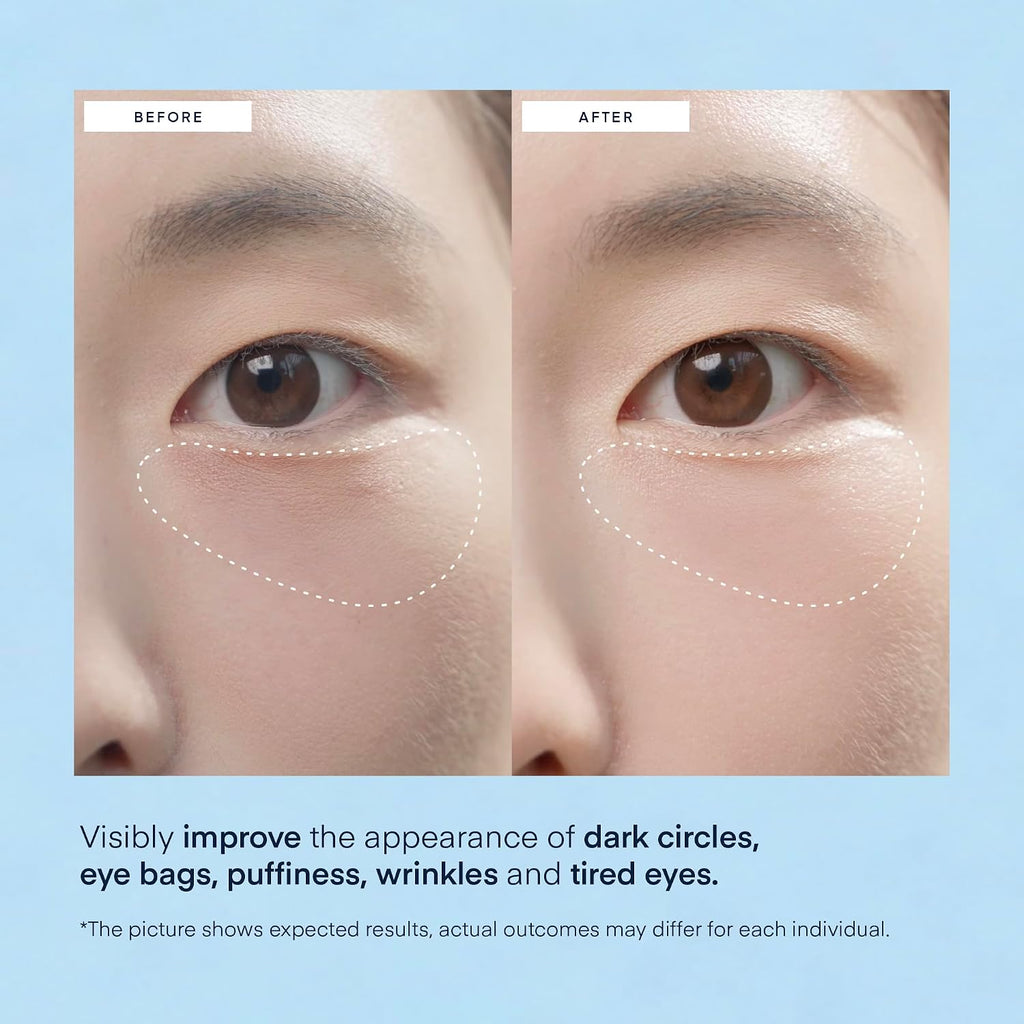TEREZ & HONOR Caffeine Under Eye Patches - 60 Korean Hydrogel Eye Masks for Puffy Eyes & Dark Circles with Hyaluronic Ac