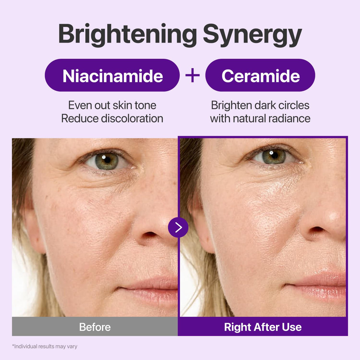 numbuzin No.9 NAD+ Retinal Eye Cream for Anti-Aging, Strawberry Skin, Firmer Skin with Retinoid, Peptides & Niacinamide,