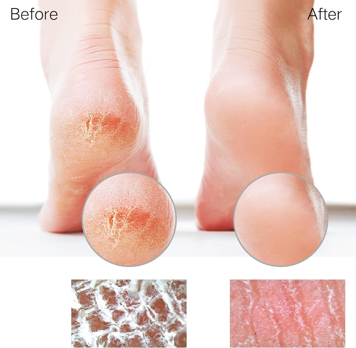 Glass Foot File Callus Remover for Feet, Heel Scraper, Pumice Stone, Diabetic Feet Scrubber Dead Skin Remover for Feet P