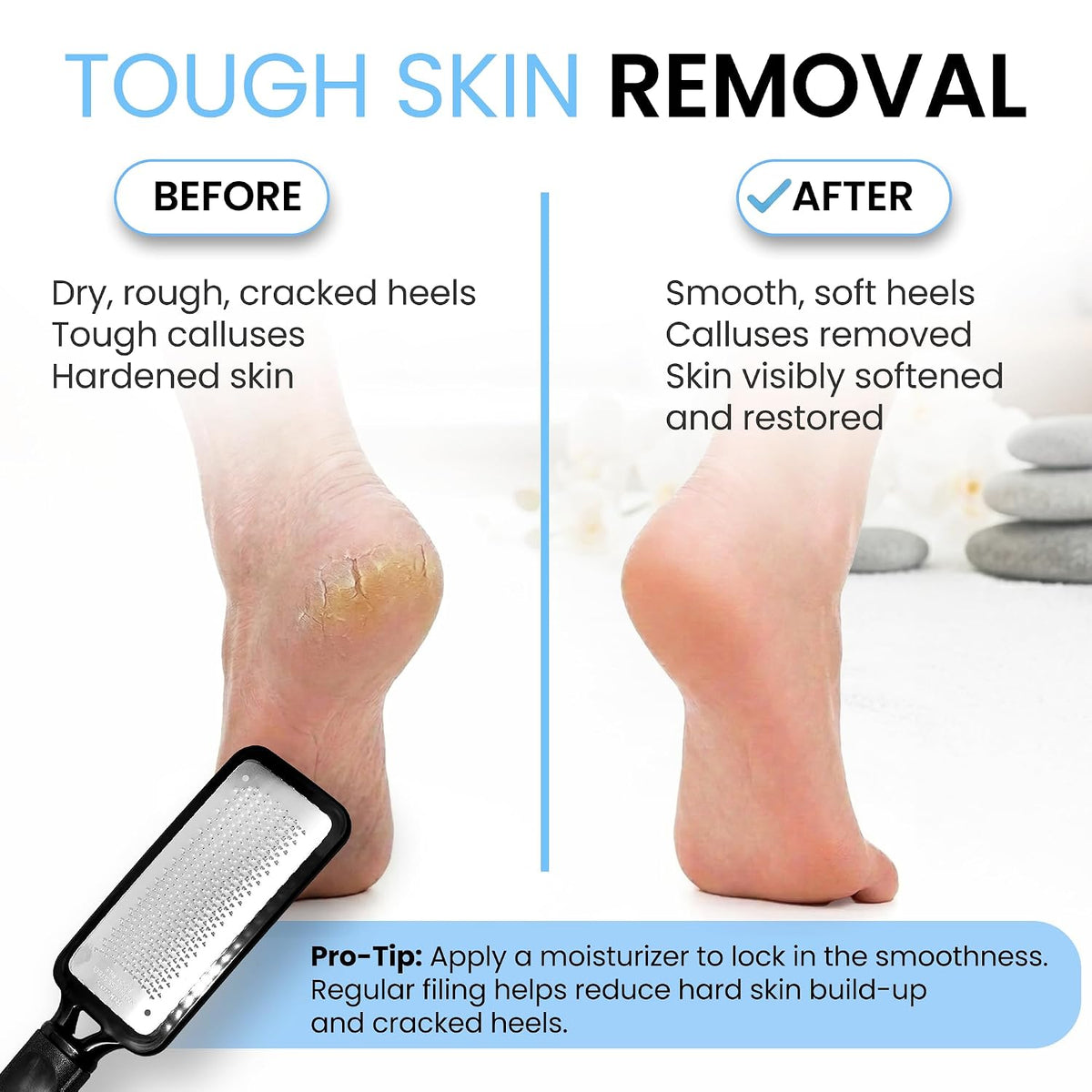 Rikans Colossal Foot File Foot Rasp Callus Remover for Soft Smooth Feet