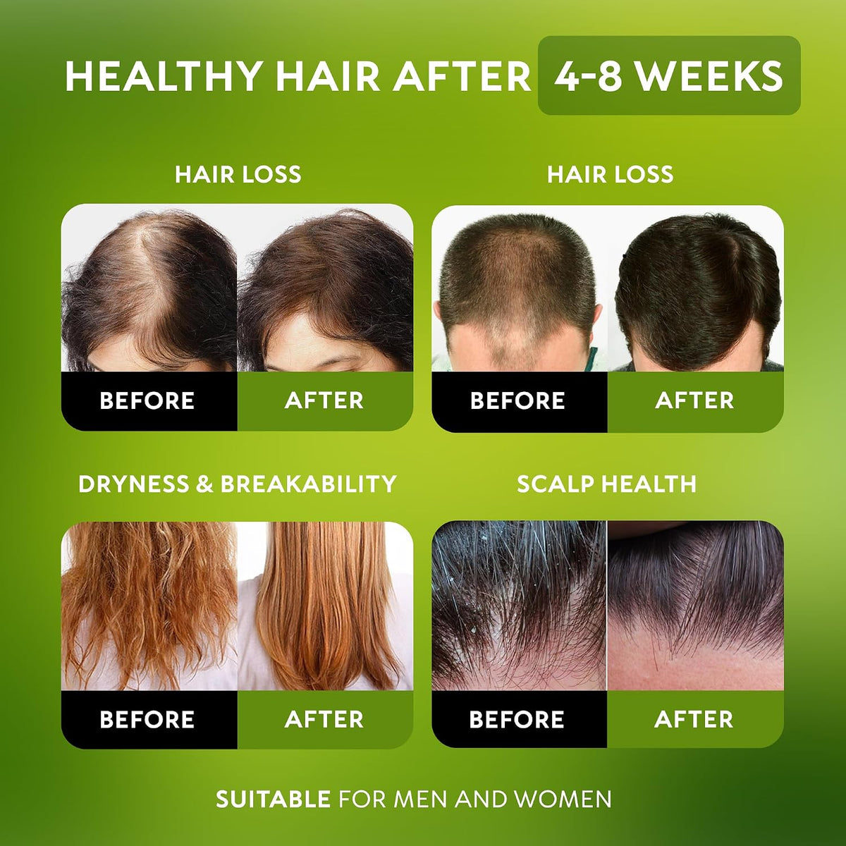 Batana Oil for Hair Growth - 100% Raw & Organic Unrefined Batana Oil - Cold Pressed Hair Mask for Scalp Health, Thicker 