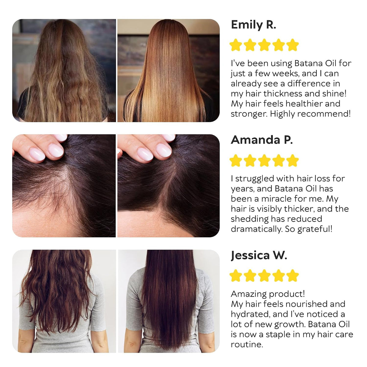 Batana Oil for Hair Growth - 100% Raw & Organic Unrefined Batana Oil - Cold Pressed Hair Mask for Scalp Health, Thicker 