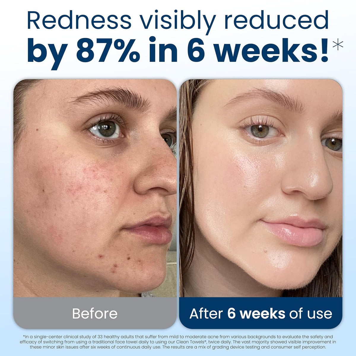 Clean Skin Club Clean Towels XL®, 100% USDA Biobased Face Towel, Disposable Face Towelette, Eczema Association Accepted,