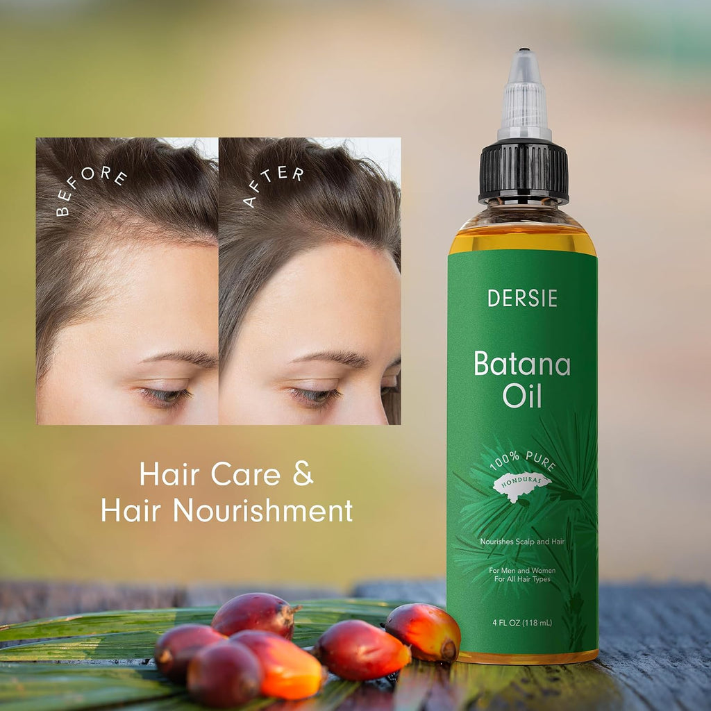 Dersie 100% Pure Batana Oil - Organic Lightweight Leave-In & Pre-Wash Oil for Dry, Damaged, High Porosity Hair - Scalp &
