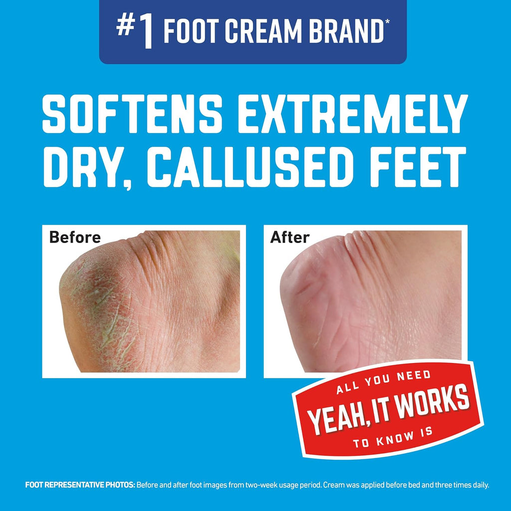 OKeeffes Healthy Feet Intense Renewal Cream, 3 oz Tube, 1-Pack