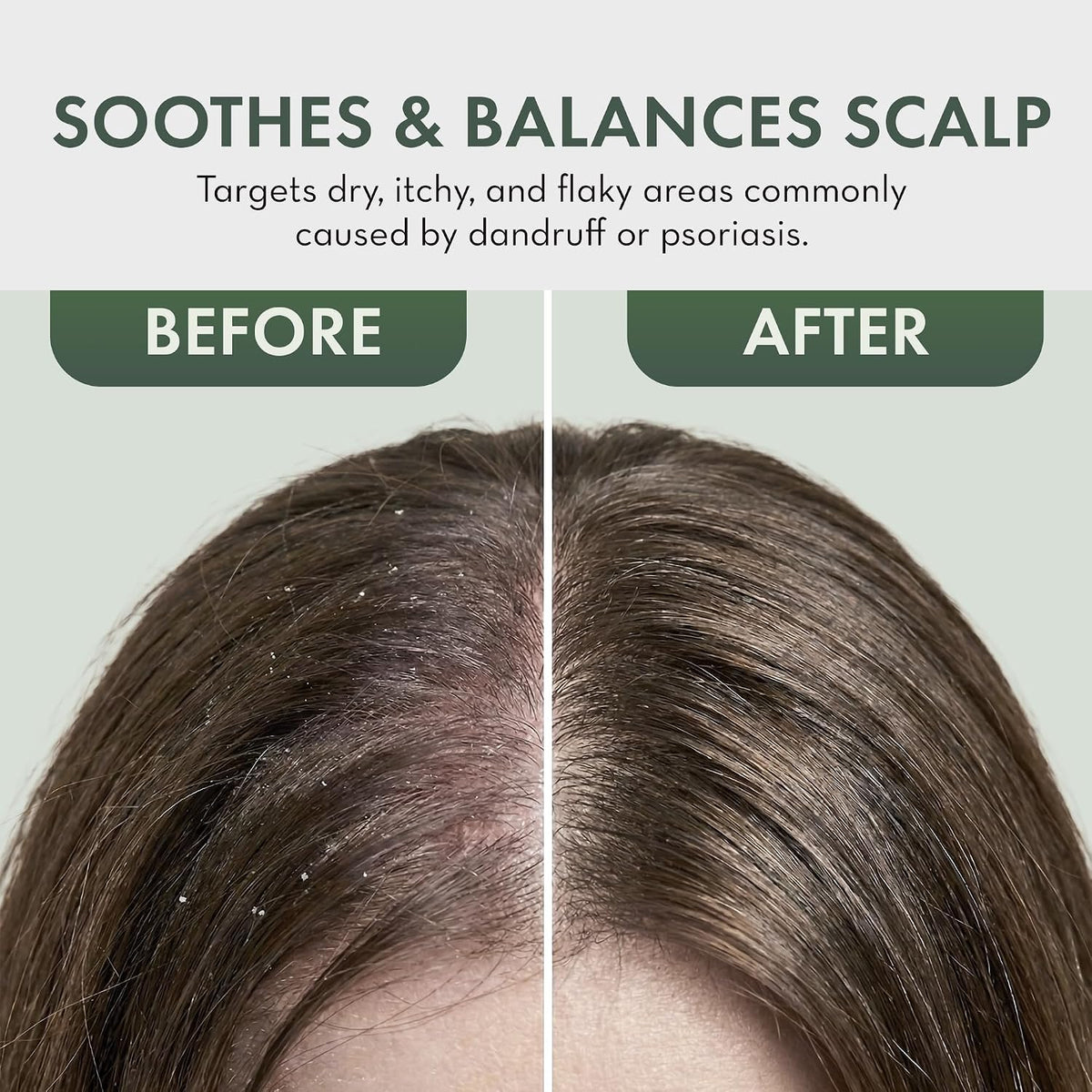 Tea Tree Oil Leave in Conditioner Spray - Dry Itchy Scalp Treatment