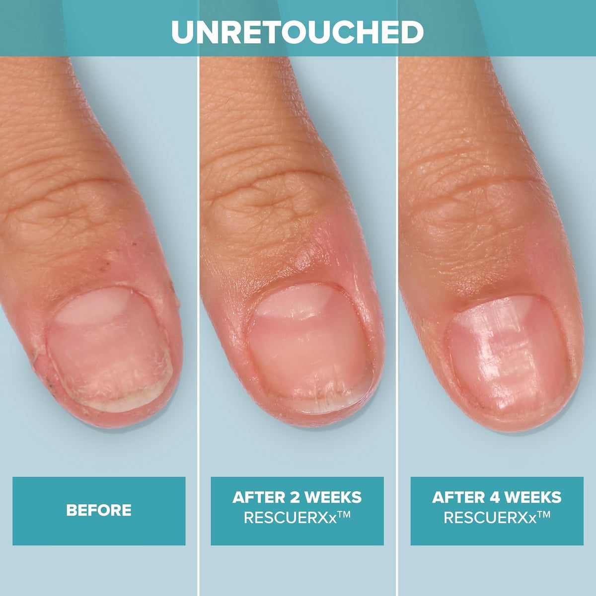 CND RescueRxx Nail Care Daily Keratin Treatment